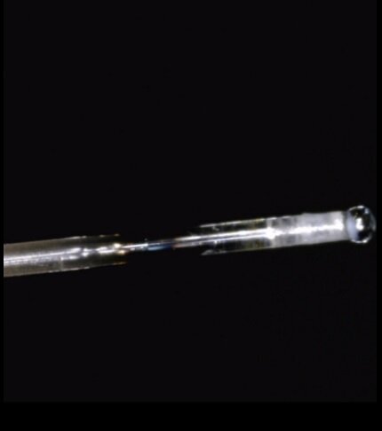 Fig. 3 - Questo tip da 200 μ ha subito un forte riscaldamento della punta del  Core e non è più utilizzabile  poiché il bulbo, caldissimo,  trattiene l’energia al suo  interno.