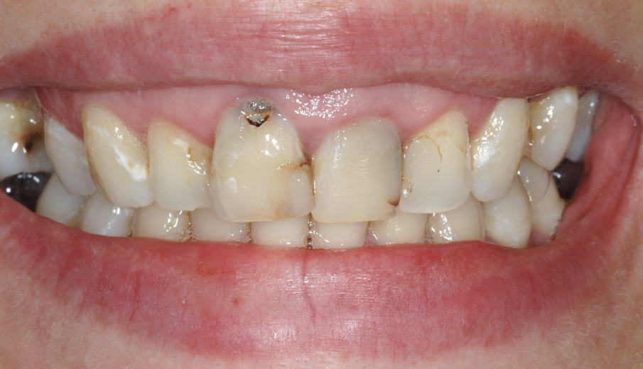 Figg. 1, 2 - Situazione iniziale. 