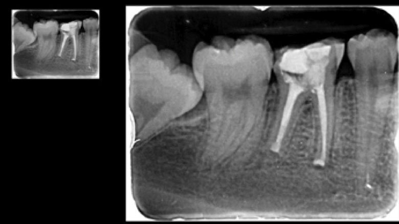 Figura 8. Control a los 2 años, donde se observa cicatrización completa.