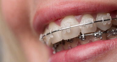 KFO im Fokus des Bayerischen Zahnärztetages