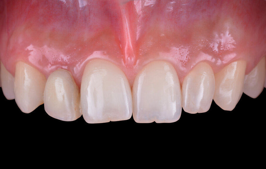 Fig. 2 - Situazione clinica iniziale (visione frontale).