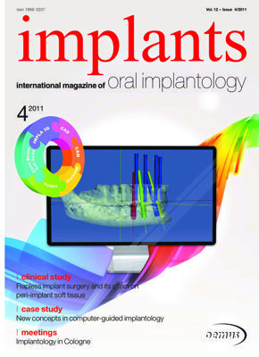 implants international No. 4, 2011 implants international No. 4, 2011
