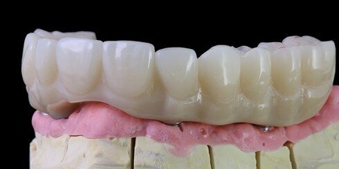 Provizorium TEMPMultilayer