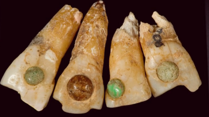 Odontología Precolombina (Museo de la Odontologia, Ep.2)