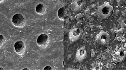 How dental sensitivity can be improved with BioMinF