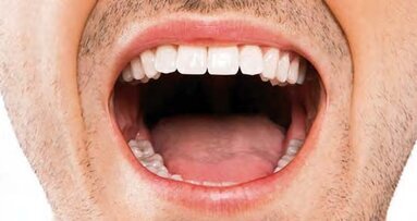 Oralne bakterije mogu biti odgovorne za infekcije koje se prenose hranom