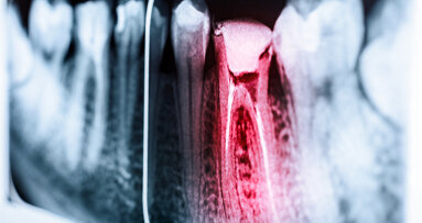 Researchers plan to develop smartphone sensor to detect tooth pain