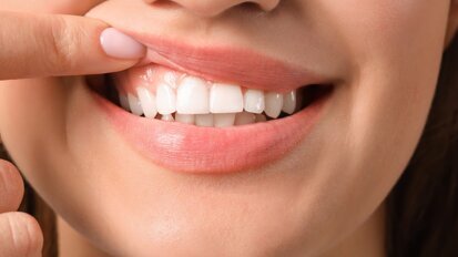 Approccio multidisciplinare alle patologie gengivali: dalla diagnosi alla terapia