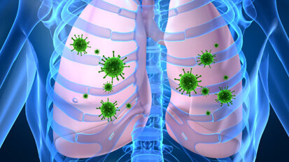 Irish dentists warn of potential dangers of dental infection