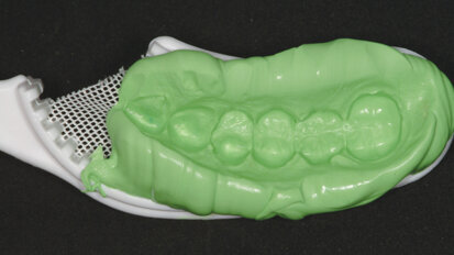 Kada da zatražite ponovno uzimanje otiska