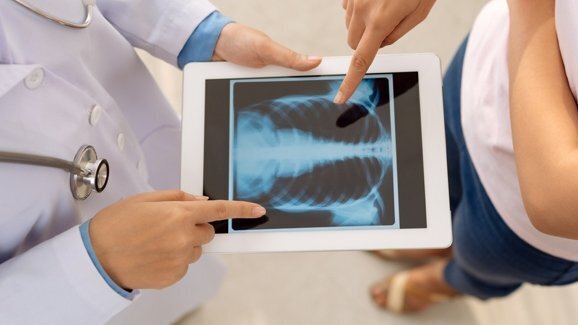 Pour éviter les pneumonies, rendez-vous régulièrement chez le dentiste!