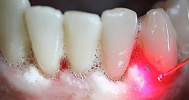 Fomation inédite au laser