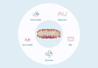 Align Technology – Align Oral Health Suite