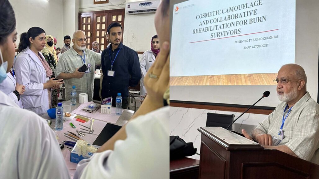 de’Mont. College of Dentistry hosts hands-on workshop on maxillofacial prosthesis