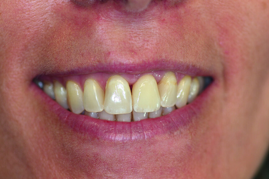 Fig. 11: The final result.