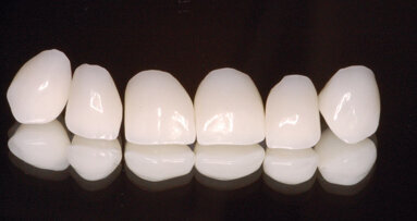 Co CAD/CAM zmienia w gabinecie