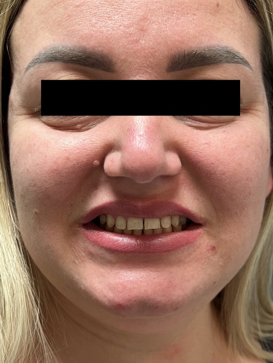 Fig. 4 - Volto della paziente.