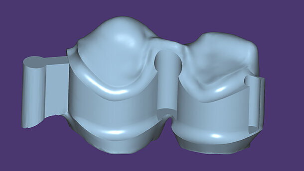 exocad DentalCAD: la nuova generazione