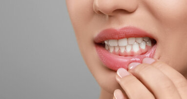 Parodontitis und Diabetes: Studie deckt neue Zusammenhänge auf