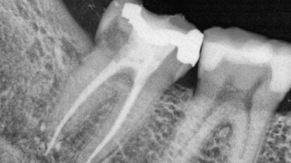 Jak se dostat do bodu 00.00
