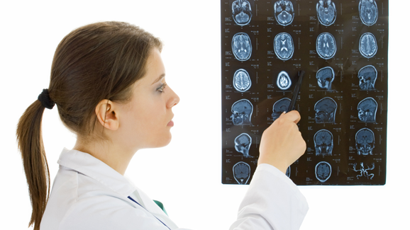 Der Entstehung von Ameloblastomen auf der Spur