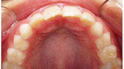 Mystery and controversy are directly proportional