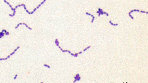 Rol van mondbacteriën bij endocarditis in kaart gebracht