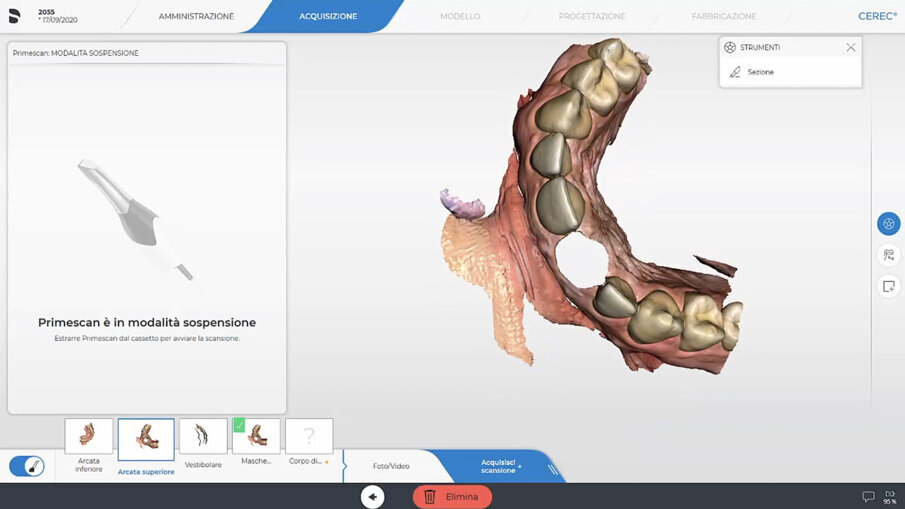 Fig. 10_Impronte digitali.