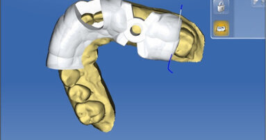 À l’aube de l’intelligence artificielle, comment tirer profit de la technologie pour garder la main sur nos traitements
