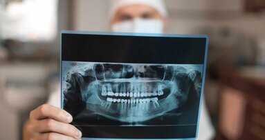 Beseitigung von Karies und Parodontitis erhöht Sicherheit bei Endoprothesen