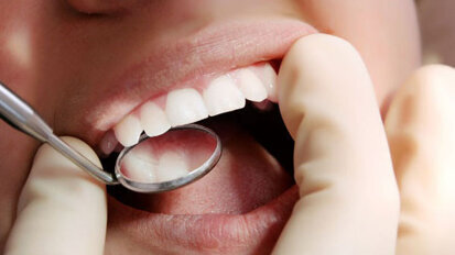 新加坡医学专业人员中牙医最吃香