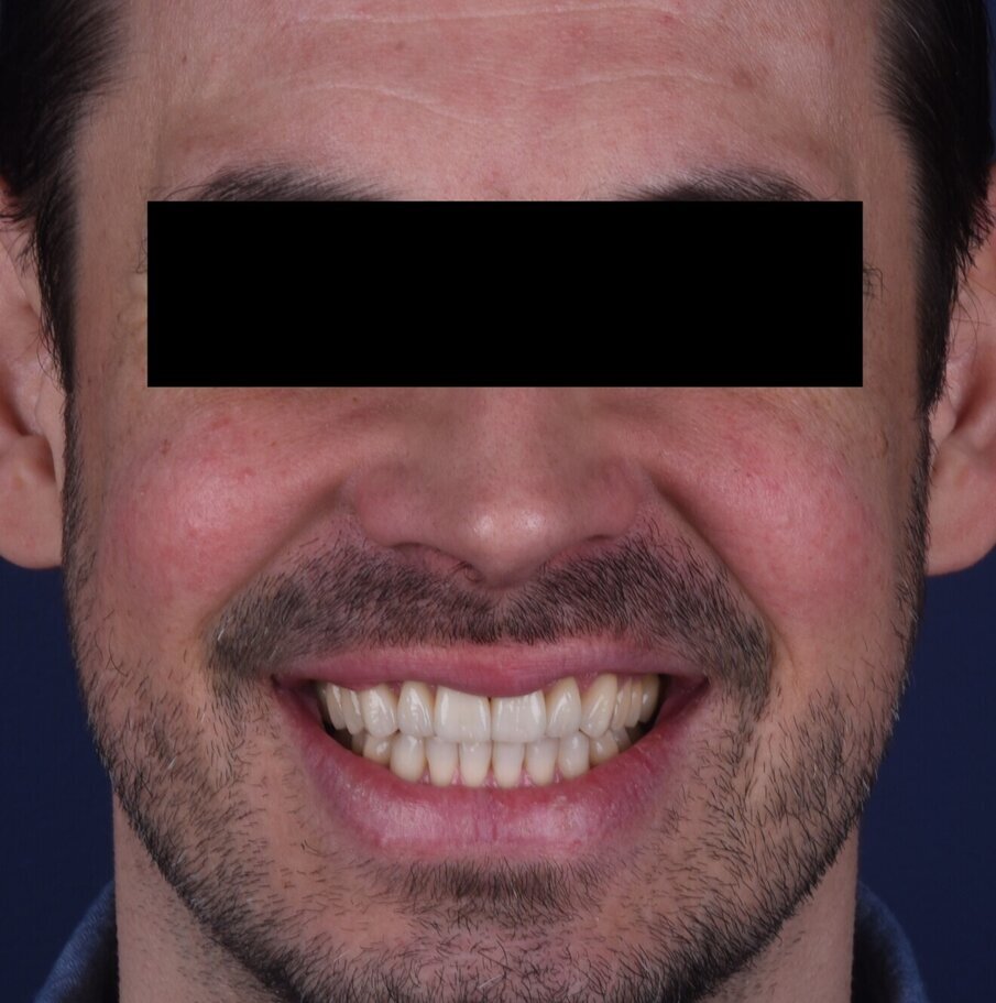 Obr. 16a: Závěrečná extraorální fotografie.