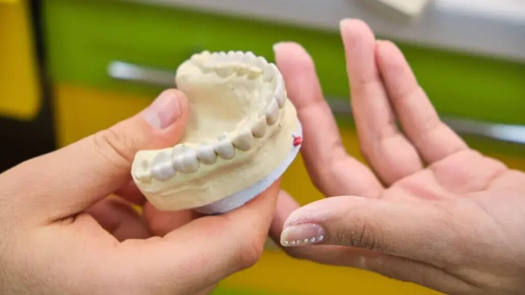 3D принтираните зъби за протези са подходящи за дългосрочна клинична употреба