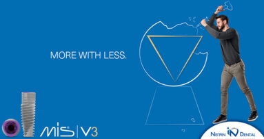 V3 implant by MIS | More with Less / NΕΓΡΙΝ ΙΝ Dental V3 implant by MIS | More with Less / NΕΓΡΙΝ ΙΝ Dental