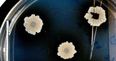 Strukturen des Biofilms und deren Auswirkungen entschlüsselt