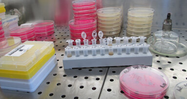 Polscy naukowcy współtwórcami sposobu na oporne bakterie