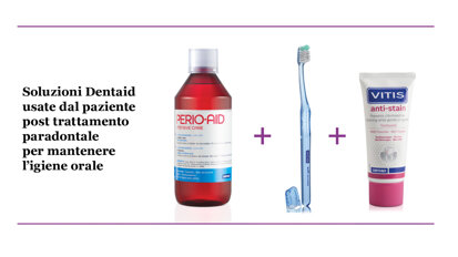 Trattamento di una Parodontite Stadio III Grado C con CHX 0,12%+CPC 0,05% e dentifricio Vitis  antistain