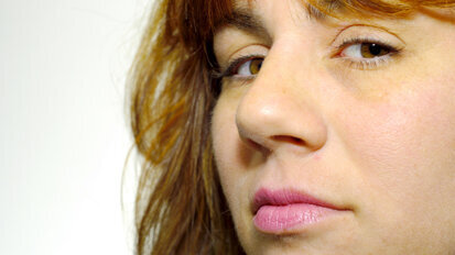 Many with facial paralysis are socially adjusted Many with facial paralysis are socially adjusted