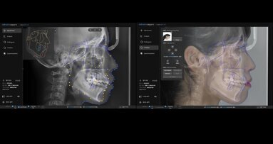 CEPPRO: Evolving beyond digital orthodontic diagnosis