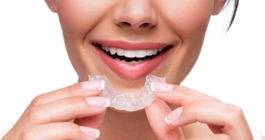 Alineadores y biocompatibilidad