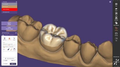 Exocad veröffentlicht ChairsideCAD 3.1 Rijeka mit neuen Features für Restaurationen in einer Sitzung