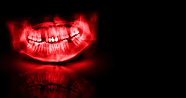 Мащабно проучване изследва връзката между оралното здраве и бъбречните заболявания