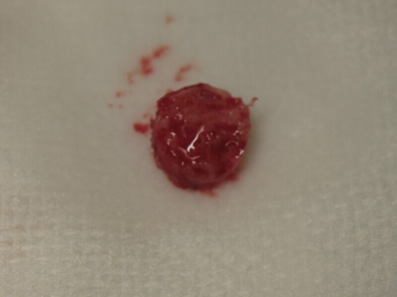 Fig. 6 : Carotte corticospongieuse. 