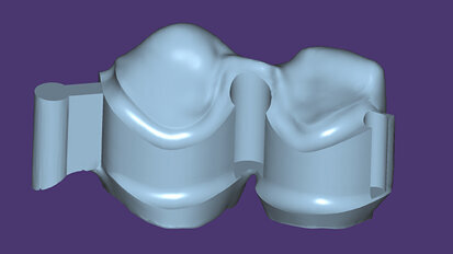 exocad DentalCAD: la nuova generazione