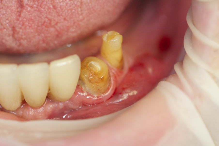 Fig.12 - Gli elementi 3.3 e 3.4 devono essere estratti.