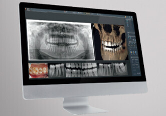 Dentsply Sirona – SIDEXIS 4