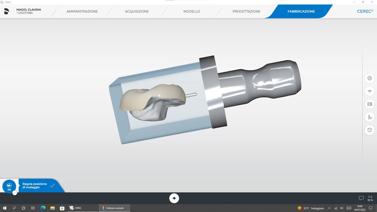 Fig. 5c: Positioning of the restoration in the virtual block before milling. 