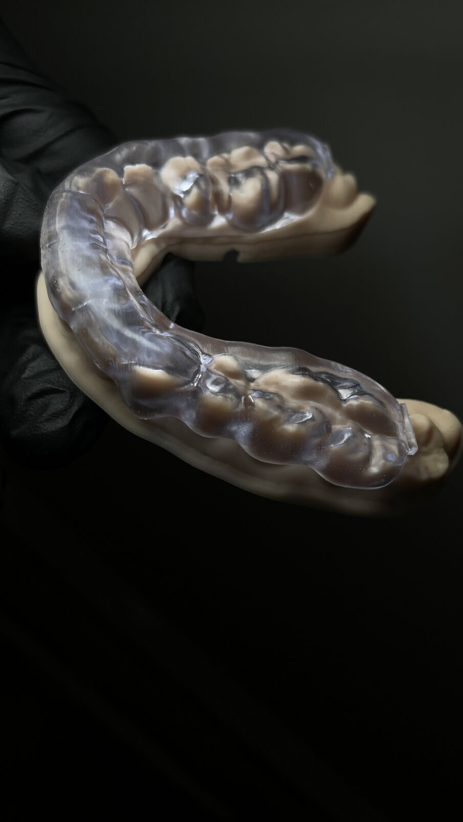 Obr. 9a–c: Okluzní pohled na dlahu (c).