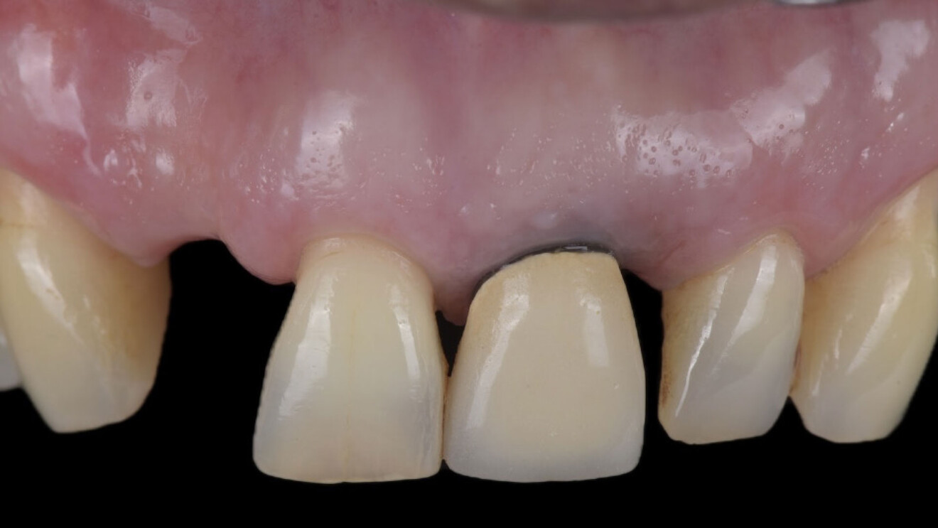 Fig. 2