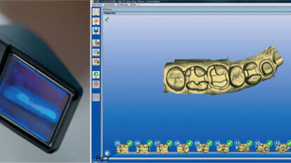 Simplified digital impression-taking